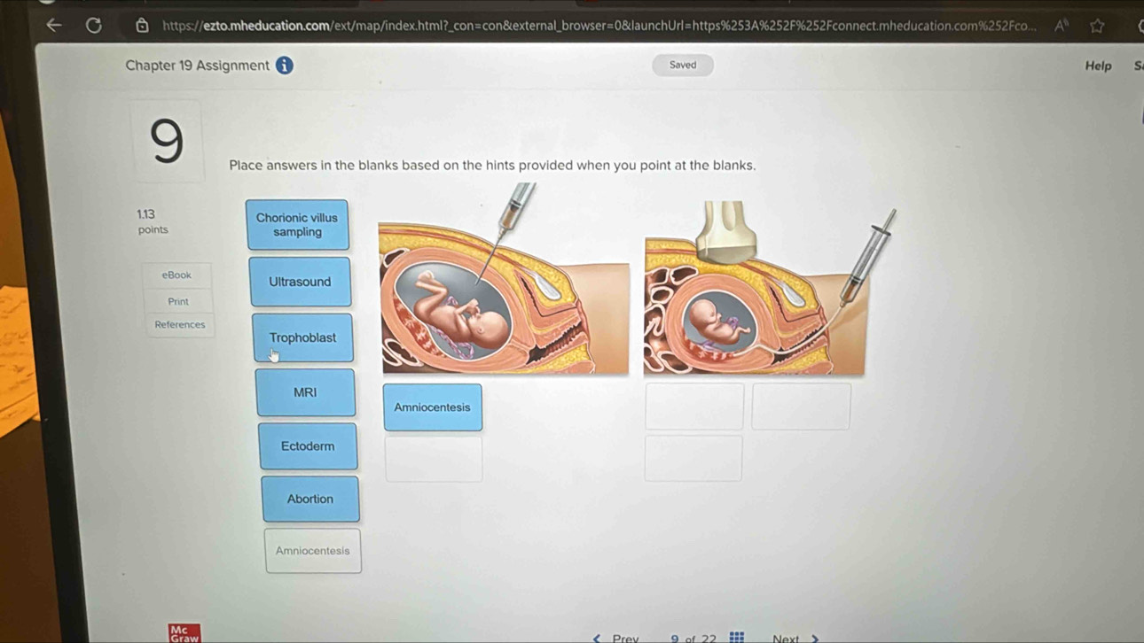 Chapter 19 Assignment Saved Help S 
9 
Place answers in the blanks based on the hints provided when you point at the blanks. 
1.13 Chorionic villus 
points sampling 
eBook Ultrasound 
Print 
References 
Trophoblast 
MRI 
Amniocentesis 
Ectoderm 
Abortion 
Amniocentesis