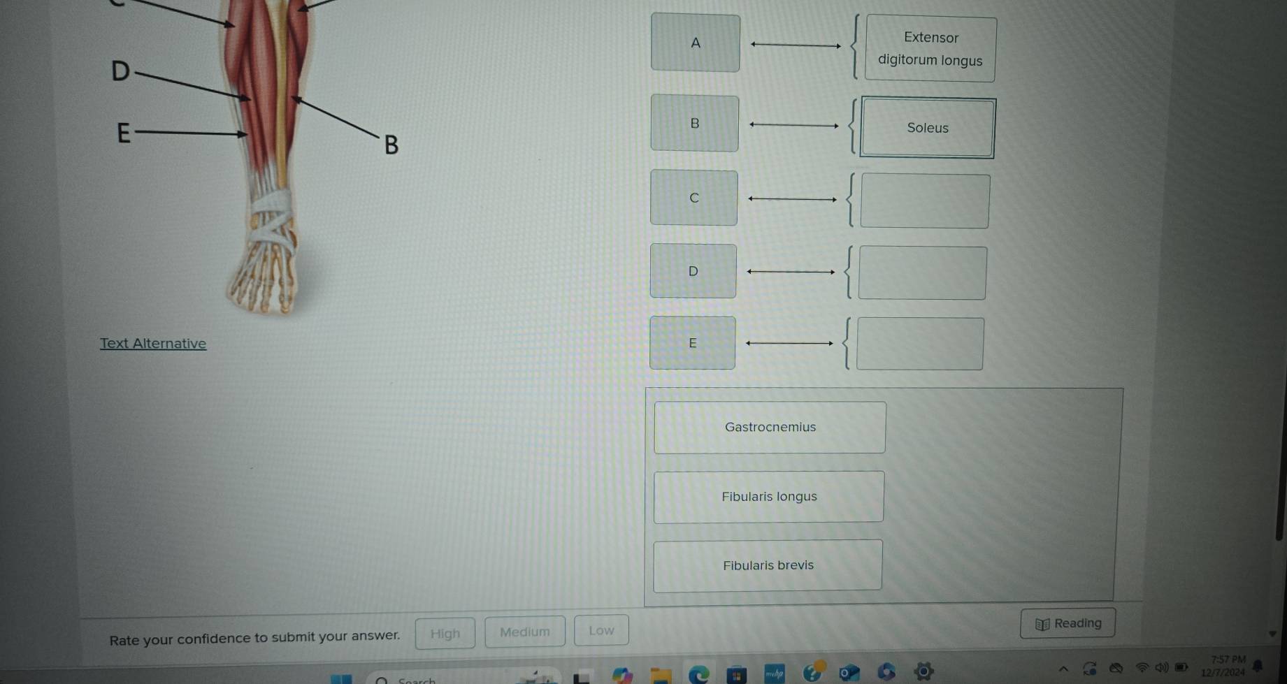 A
Extensor
digitorum longus
B
Soleus
C
D
Gastrocnemius
Fibularis longus
Fibularis brevis
Rate your confidence to submit your answer. High Medium Low
€ Reading
7:57 PM
12/7/2024