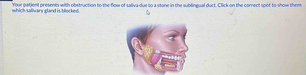 Your patient presents with obstruction to the flow of saliva due to a stone in the sublingual duct. Click on the correct spot to show them 
which salivary gland is blocked.