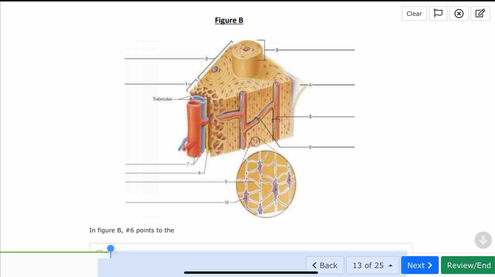 Clear 
Figure B 
In figure B, #6 points to the 
Back 13 of 25 Next> Review/End