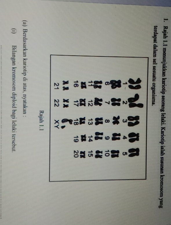 Rajah 1.1 menunjukkan kariotip seorang lelaki. Kariotip ialah susunan kromosom yang 
terdapat dalam sel sesuatu organisma. 
Rajah 1.1 
(a) Berdasarkan kariotip di atas, nyatakan : 
(i) Bilangan kromosom diploid bagi lelaki tersebut. 
_