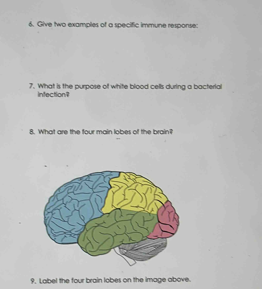 Give two examples of a specific immune response: 
7. What is the purpose of white blood cells during a bacterial 
infection? 
8. What are the four main lobes of the brain? 
9. Label the four brain lobes on the image above.