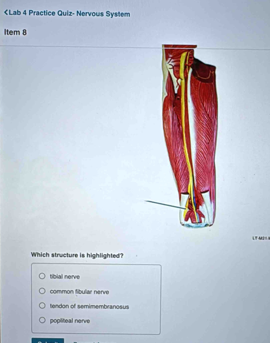 tibial nerve
common fibular nerve
tendon of semimembranosus
popliteal nerve