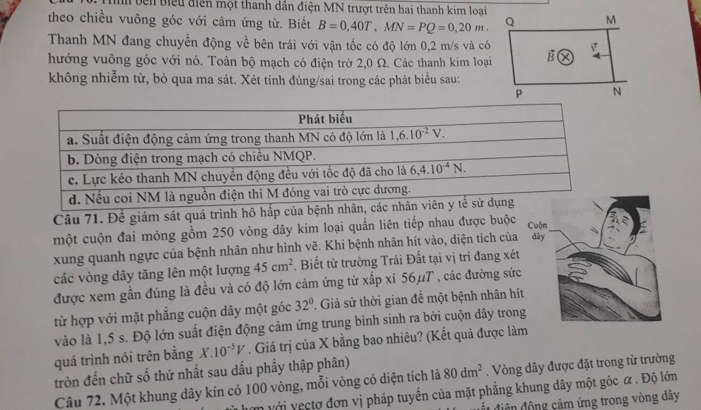 bên Biểu điễn một thanh dần điện MN trượt trên hai thanh kim loại
theo chiều vuông góc với cảm ứng từ. Biết B=0,40T,MN=PQ=0,20m.
Thanh MN đang chuyền động về bên trái với vận tốc có độ lớn 0,2 m/s và có
hướng vuông góc với nó. Toàn bộ mạch có điện trở 2,0 Ω. Các thanh kim loại
không nhiễm từ, bỏ qua ma sát. Xét tính đúng/sai trong các phát biểu sau:
Câu 71. Để giám sát quá trình hô hấp của bện
một cuộn đai mỏng gồm 250 vòng dây kim loại quấn liên tiếp nhau được buộc
xung quanh ngực của bệnh nhân như hình vẽ. Khi bệnh nhân hít vào, diện tích của
các vòng dây tăng lên một lượng 45cm^2. Biết từ trường Trái Đất tại vị trí đang xét
được xem gần đúng là đều và có độ lớn cảm ứng từ xấp xỉ 56μT , các đường sức
từ hợp với mặt phẳng cuộn dây một góc 32° Giả sử thời gian đề một bệnh nhân hít
vào là 1,5 s. Độ lớn suất điện động cảm ứng trung bình sinh ra bởi cuộn dây trong
quá trình nói trên bằng X.10^(-5)V. Giá trị của X bằng bao nhiêu? (Kết quả được là
tròn đến chữ số thứ nhất sau dấu phầy thập phân)
Câu 72. Một khung dây kín có 100 vòng, mỗi vòng có diện tích là 80dm^2. Vòng dây được đặt trong từ trường
n với vectơ đơn vị pháp tuyển của mặt phẳng khung dây một góc α . Độ lớn
điện động cảm ứng trong vòng dây