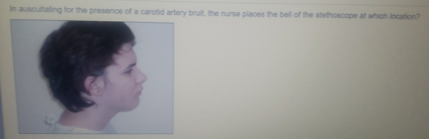 In auscultating for the presence of a carotid artery bruit, the nurse places the bell of the stethoscope at which location?