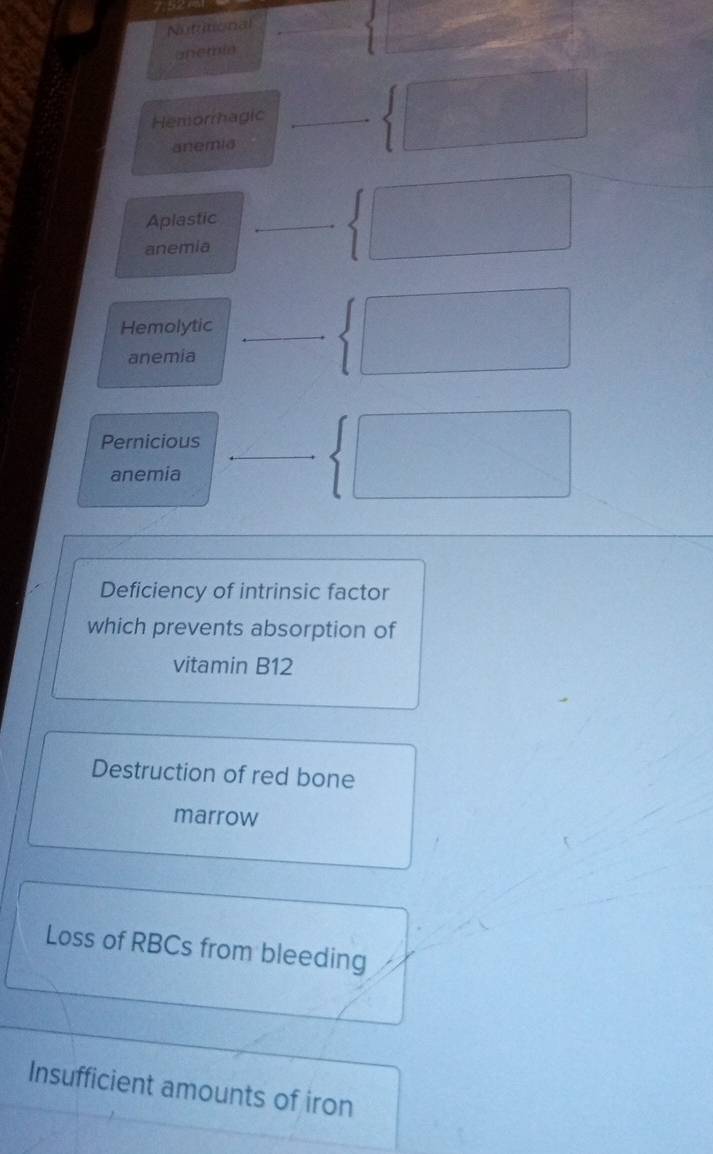 Nututional_
unemhia
Hemorrhagic_
anemia
Aplastic_
anemia
Hemolytic_
anemia
_
Pernicious
anemia
Deficiency of intrinsic factor
which prevents absorption of
vitamin B12
Destruction of red bone
marrow
Loss of RBCs from bleeding
Insufficient amounts of iron