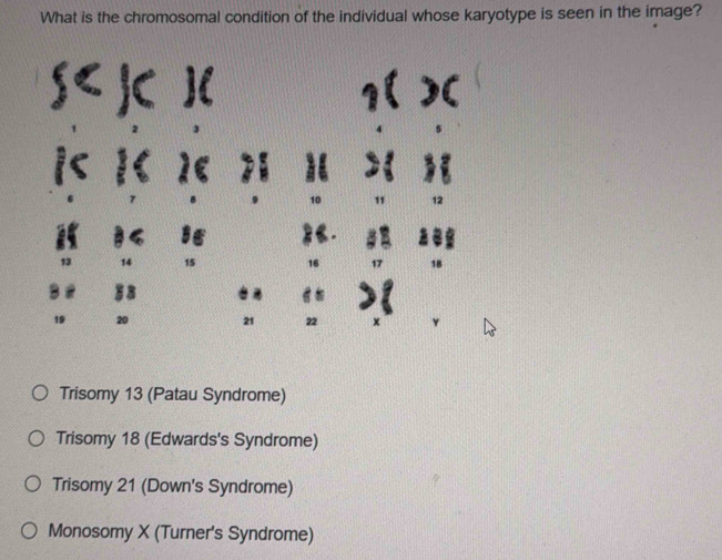 What is the chromosomal condition of the individual whose karyotype is seen in the image?

a I
10 "
13 14 15 16
§ 8

19 20 21 22 x
Trisomy 13 (Patau Syndrome)
Trisomy 18 (Edwards's Syndrome)
Trisomy 21 (Down's Syndrome)
Monosomy X (Turner's Syndrome)