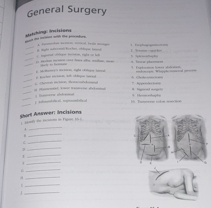 Solved: Matching: Incisions Match the incision with the procedure. _ A ...