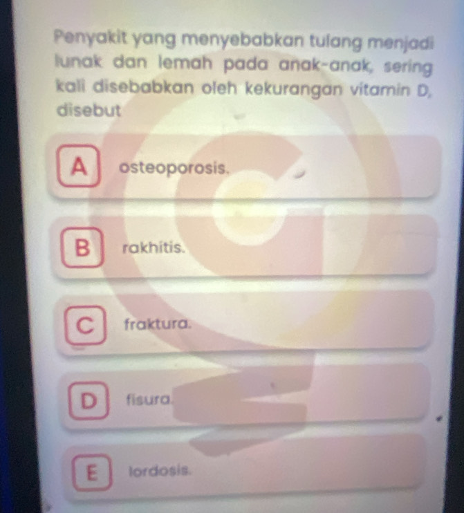 Penyakit yang menyebabkan tulang menjadi
lunak dan lemah pada anak-anak, sering
kali disebabkan oleh kekurangan vitamin D,
disebut
A osteoporosis.
B rakhítis.
fraktura.
D fisura
E lordosis.