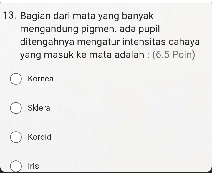 Bagian dari mata yang banyak
mengandung pigmen. ada pupil
ditengahnya mengatur intensitas cahaya
yang masuk ke mata adalah : (6.5 Poin)
Kornea
Sklera
Koroid
Iris