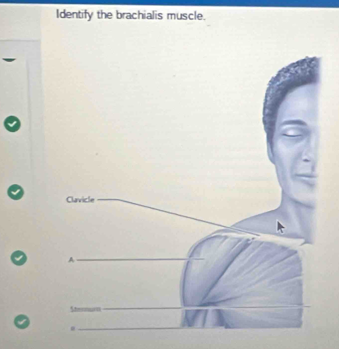 Identify the brachialis muscle.