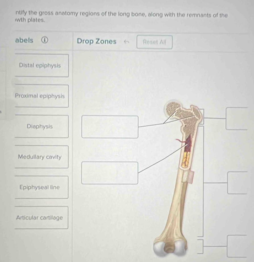 ntify the gross anatomy regions of the long bone, along with the remnants of the 
wth plates.