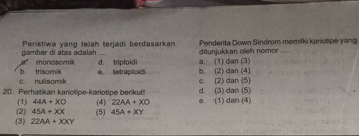 Peristiwa yang telah terjadi berdasarkan Penderita Down Sindrom memilki kariotipe yang
gambar di atas adalah ... ditunjukkan oleh nomor ....
a monosomik d. triploidi a. (1) dan (3)
b. trisomik e. tetraploidi b. (2) dan (4)
c. nulisomik c. (2) dan (5)
20. Perhatikan kariotipe-kariotipe berikut! d. (3) dan (5)
(1) 44A+XO (4) 22AA+XO e. . (1) dan (4)
(2) 45A+XX (5) 45A+XY
(3) 22AA+XXY