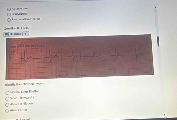 AuM Fler
Bradycardia
Junctional Bradycardia
Question 8 (1 point)
Listen
Identify the following rhythm.
Normal Sinus Rhythm
Sinus Tachycardia
Atrial Fibrillation
Atrial Flutter