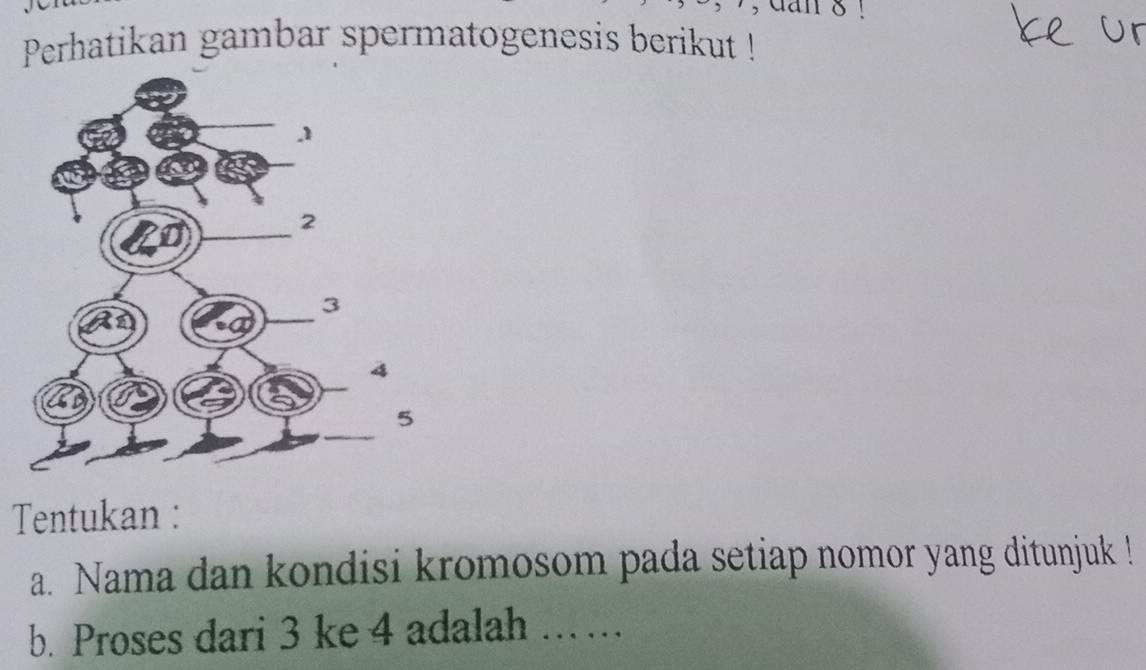 Perhatikan gambar spermatogenesis berikut ! 
Tentukan : 
a. Nama dan kondisi kromosom pada setiap nomor yang ditunjuk ! 
b. Proses dari 3 ke 4 adalah …