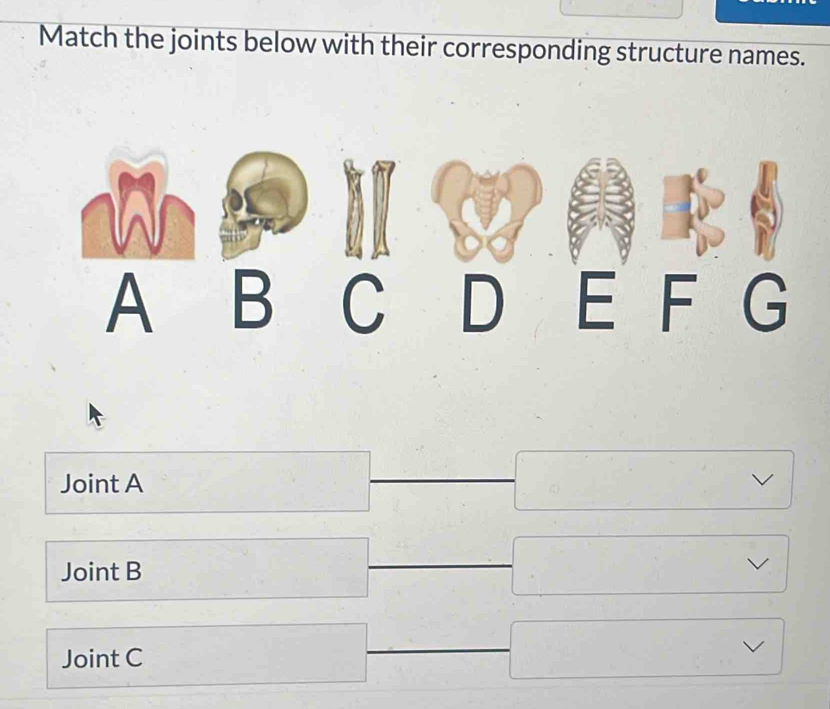 Solved: Match the joints below with their corresponding structure names ...