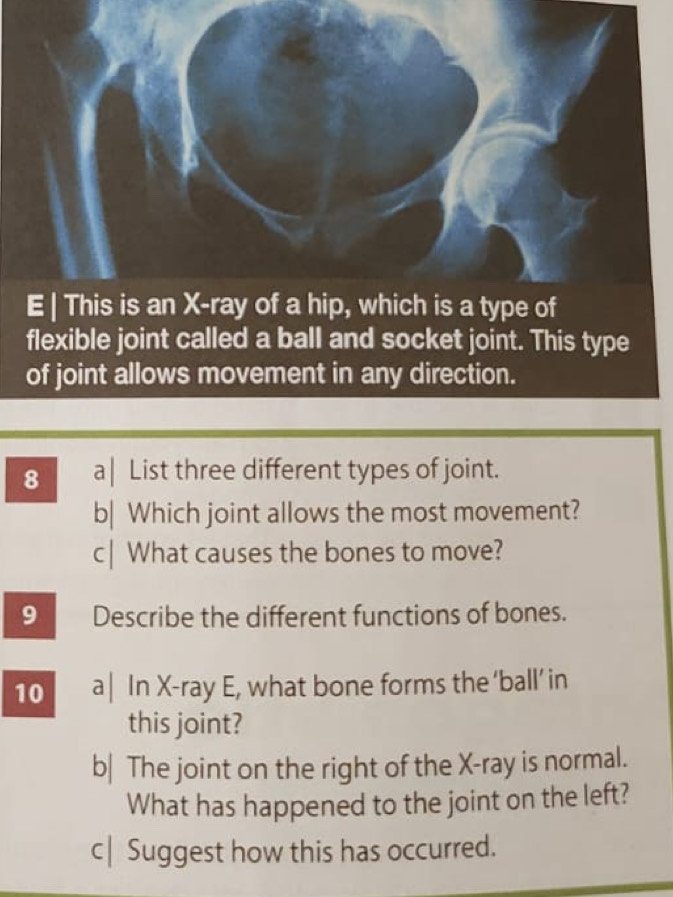 flexible joint called a ball and socket joint. This type 
of joint allows movement in any direction. 
8 a| List three different types of joint. 
b| Which joint allows the most movement? 
c| What causes the bones to move? 
9 Describe the different functions of bones. 
10 a| In X -ray E, what bone forms the‘ball’in 
this joint? 
b| The joint on the right of the X -ray is normal. 
What has happened to the joint on the left? 
c| Suggest how this has occurred.