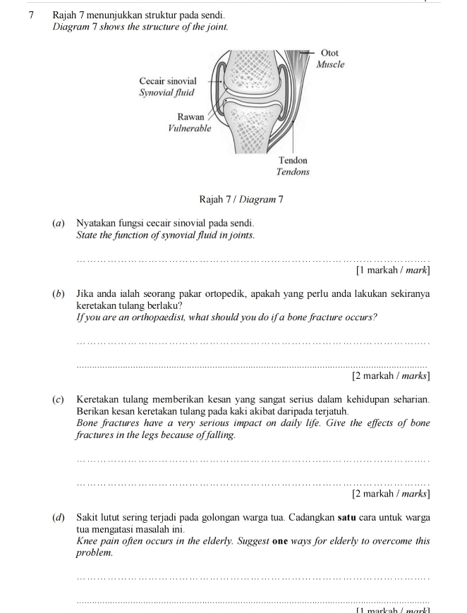 Rajah 7 menunjukkan struktur pada sendi. 
Diagram 7 shows the structure of the joint. 
Rajah 7 / Diagram 7 
(a) Nyatakan fungsi cecair sinovial pada sendi. 
State the function of synovial fluid in joints. 
_ 
[1 markah / mark] 
(b) Jika anda ialah seorang pakar ortopedik, apakah yang perlu anda lakukan sekiranya 
keretakan tulang berlaku? 
If you are an orthopaedist, what should you do if a bone fracture occurs? 
_ 
_ 
[2 markah / marks] 
(c) Keretakan tulang memberikan kesan yang sangat serius dalam kehidupan seharian. 
Berikan kesan keretakan tulang pada kaki akibat daripada terjatuh. 
Bone fractures have a very serious impact on daily life. Give the effects of bone 
fractures in the legs because of falling. 
_ 
_ 
[2 markah / marks] 
(d) Sakit lutut sering terjadi pada golongan warga tua. Cadangkan satu cara untuk warga 
tua mengatasi masalah ini. 
Knee pain often occurs in the elderly. Suggest one ways for elderly to overcome this 
problem. 
_ 
_