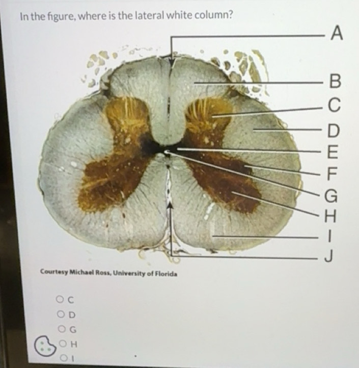 Solved: In the fgure, where is the lateral white column? Courtesy ...