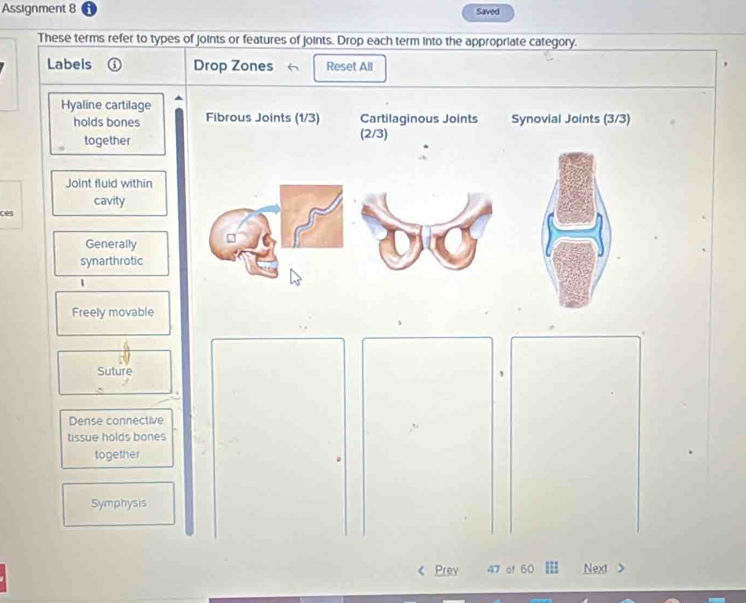 Assignment 8 Saved 
These terms refer to types of joints or features of joints. Drop each term into the appropriate category. 
Labels ① Drop Zones Reset All 
Hyaline cartilage Fibrous Joints (1/3) Cartilaginous Joints Synovial Joints (3/3)
holds bones 
together (2/3)
Joint fluid within 
cavity 
ces 
Generally 
synarthrotic
1
Freely movable 
Suture 
Dense connective 
tissue holds bones 
together 
Symphysis 
Prev 47 of 60 Next >