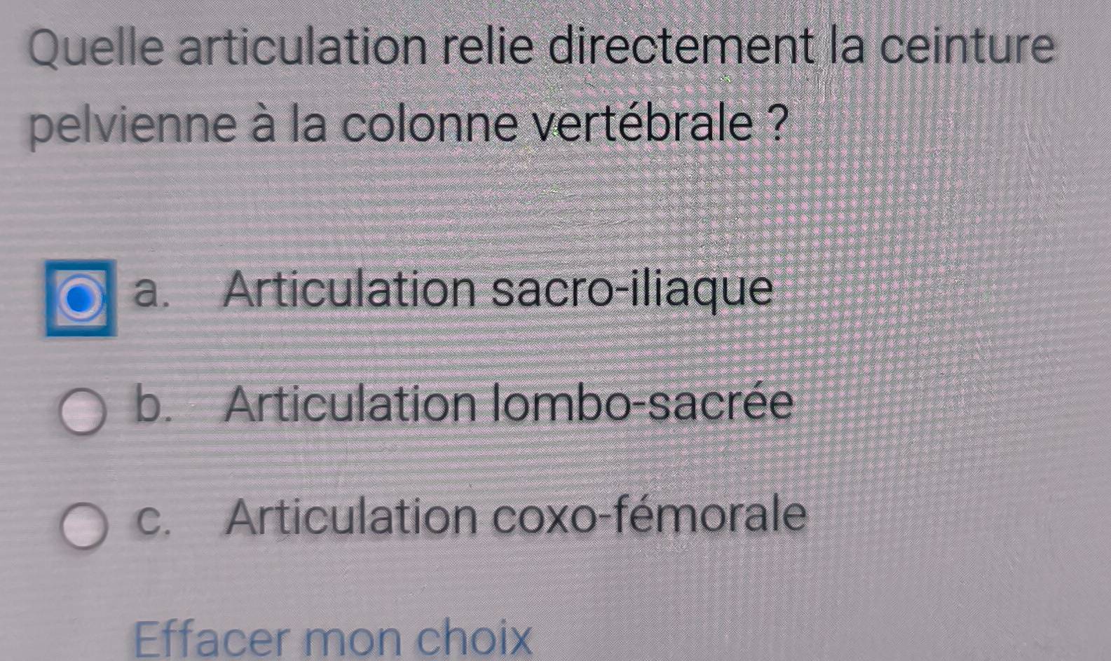 Quelle articulation relie directement la ceinture
pelvienne à la colonne vertébrale ?
a. Articulation sacro-iliaque
b. Articulation lombo-sacrée
c. Articulation coxo-fémorale
Effacer mon choix