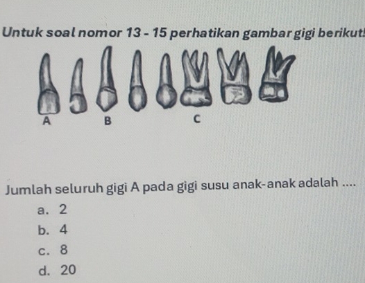 Untuk soal nomor 13-15 iperhatikan gambar gigi berikut .
Jumlah seluruh gigi A pada gigi susu anak-anak adalah ....
a. 2
b. 4
c. 8
d. 20