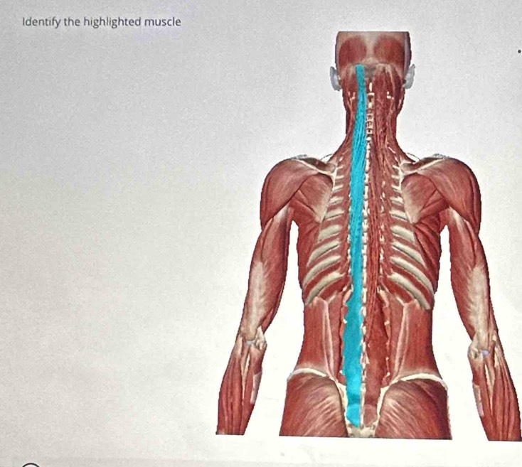 Identify the highlighted muscle