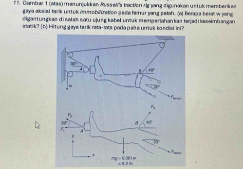 Gambar 1 (atas) menunjukkan Russell's traction rig yang digunakan untuk memberikan
gaya aksial tarik untuk immobilization pada femur yang patah. (a) Berapa berat w yang
digantungkan di salah satu ujung kabel untuk mempertahankan terjadi keseimbangan
statik? (b) Hitung gaya tarik rata-rata pada paha untuk kondisi ini?
=9.2lb