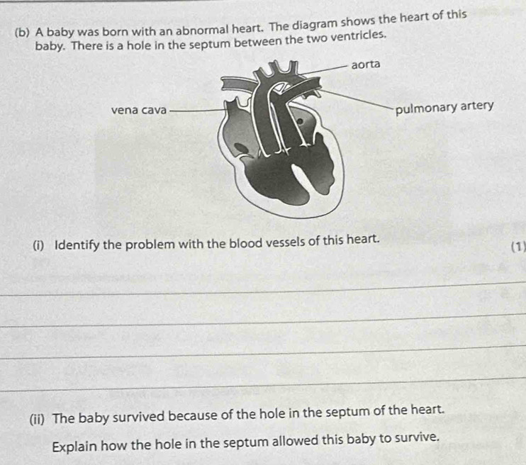 A baby was born with an abnormal heart. The diagram shows the heart of this 
baby. There is a hole in the septum between the two ventricles. 
(i) Identify the problem with the blood vessels of this heart. (1) 
_ 
_ 
_ 
_ 
(ii) The baby survived because of the hole in the septum of the heart. 
Explain how the hole in the septum allowed this baby to survive.