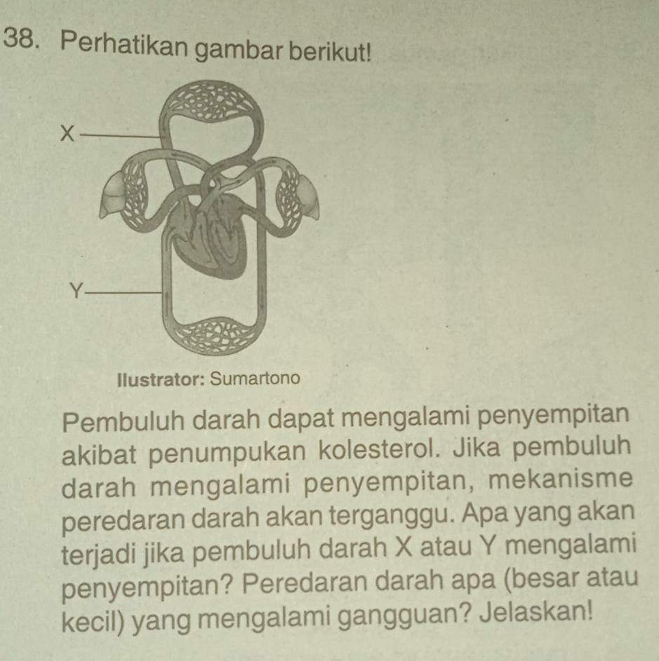 Perhatikan gambar berikut! 
Ilustrator: Sumartono 
Pembuluh darah dapat mengalami penyempitan 
akibat penumpukan kolesterol. Jika pembuluh 
darah mengalami penyempitan, mekanisme 
peredaran darah akan terganggu. Apa yang akan 
terjadi jika pembuluh darah X atau Y mengalami 
penyempitan? Peredaran darah apa (besar atau 
kecil) yang mengalami gangguan? Jelaskan!