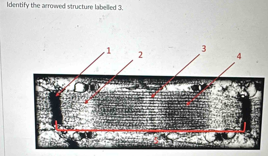 Identify the arrowed structure labelled 3.