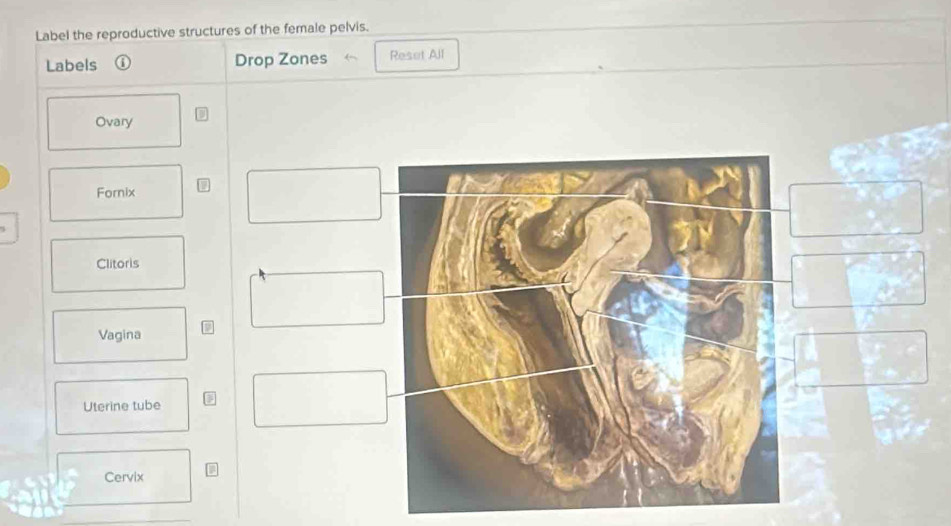Solved: Label the reproductive structures of the female pelvis. Labels ...