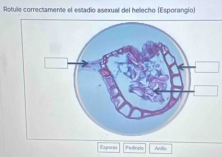 Rotule correctamente el estadio asexual del helecho (Esporangio) 
Esporas Pedicelo Anillo