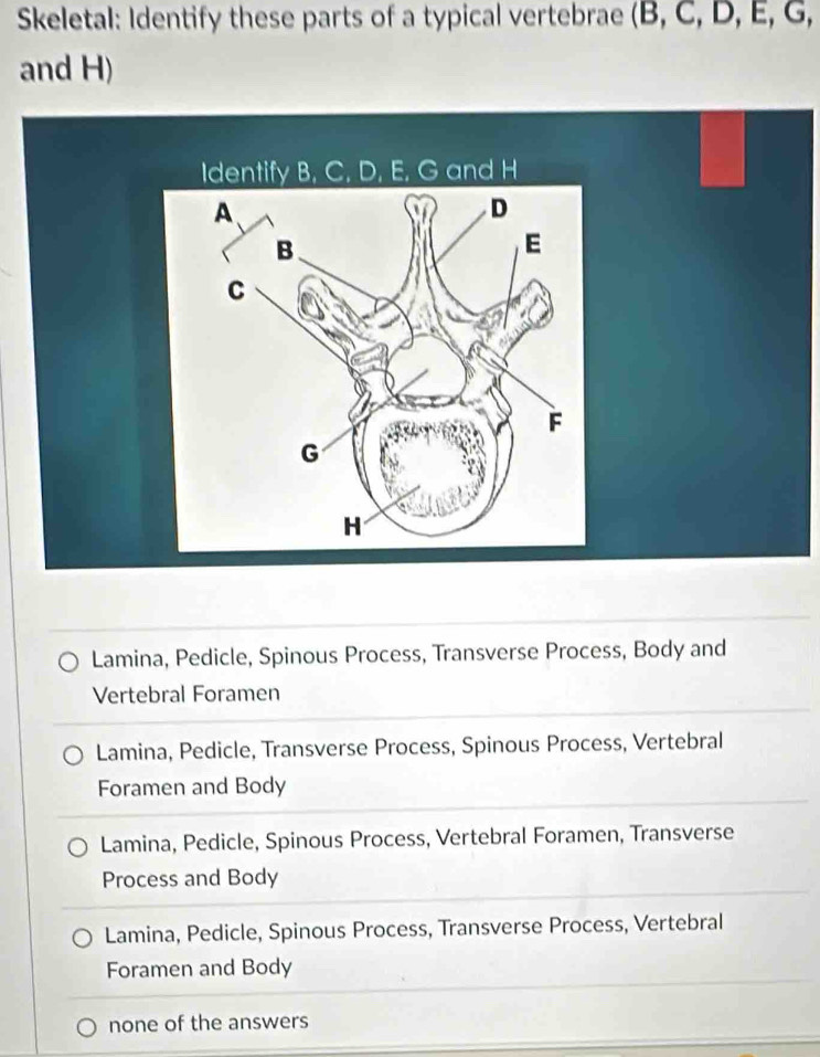 Solved: Skeletal: Identify these parts of a typical vertebrae (B, C, D ...