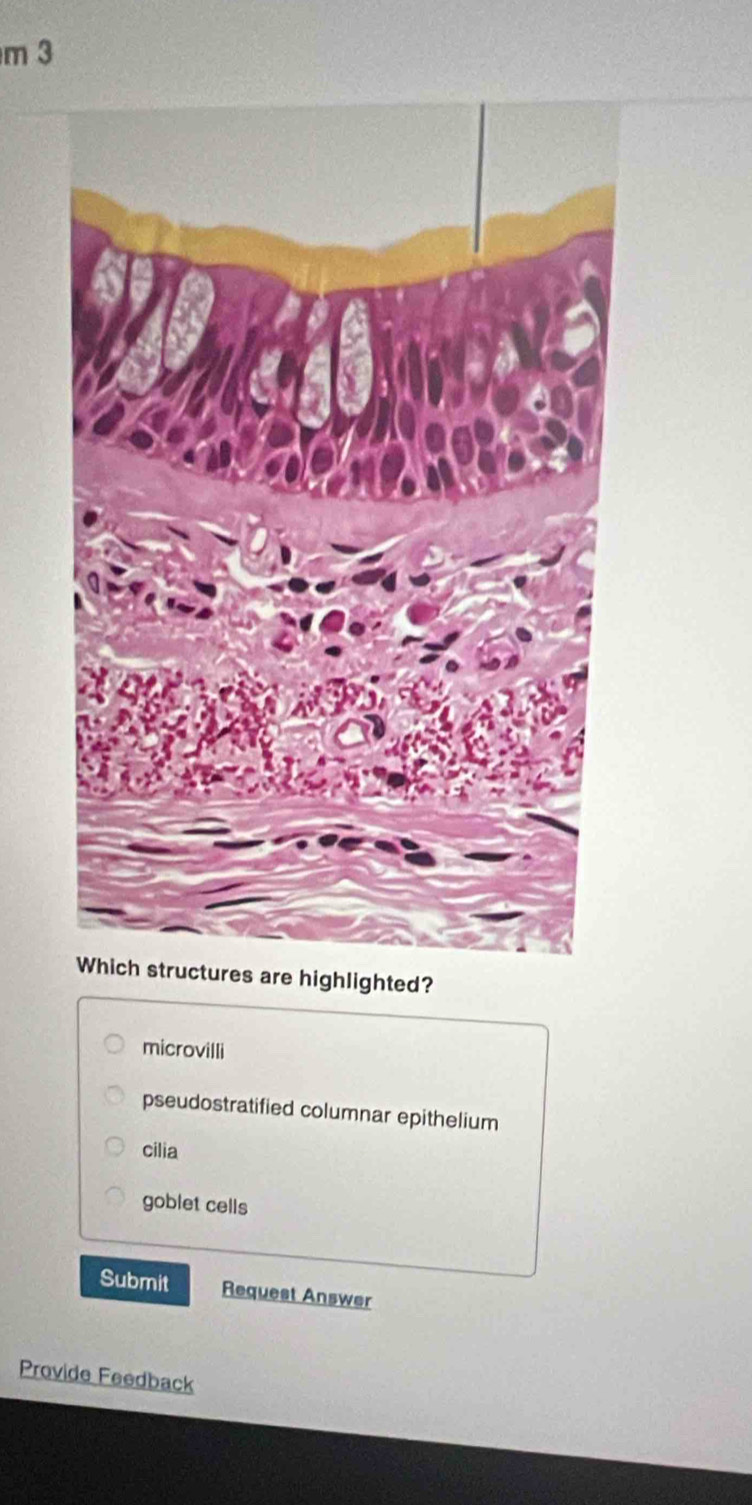 highlighted?
microvilli
pseudostratified columnar epithelium
cilia
goblet cells
Submit Request Answer
Provide Feedback