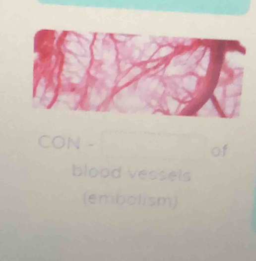 blood vess e 
(embolism)