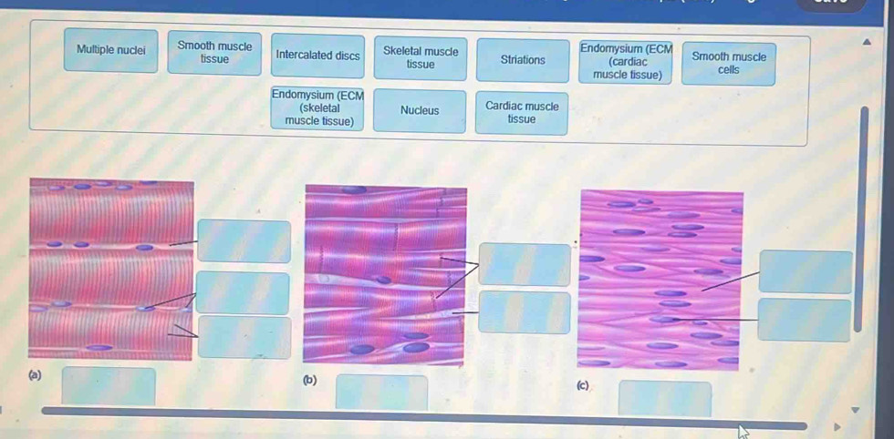 Multiple nuclei Smooth muscle Skeletal muscle Striations Endomysium (ECM Smooth muscle
tissue Intercalated discs tissue (cardiac cells
muscle tissue)
Endomysium (ECM
(skeletal Nucleus Cardiac muscle
muscle tissue) tissue
(a)
(b) (c)