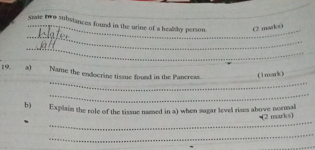 State two substances found in the urine of a healthy person. (2 marks) 
_ 
_ 
_ 
19. a) Name the endocrine tissue found in the Pancreas._ 
_(1mark) 
_ 
_ 
b) Explain the role of the tissue named in a) when sugar level rises above normal 
_ 
(2 marks) 
_ 
_