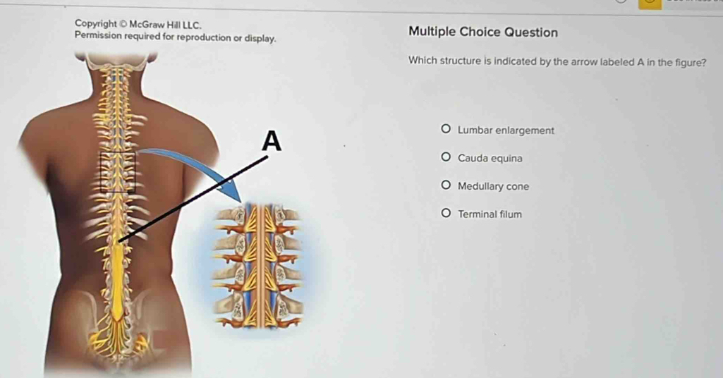 Copyright © McGraw Hill LLC. Multiple Choice Question
Permission required for reproduction or display.
Which structure is indicated by the arrow labeled A in the figure?
Lumbar enlargement
Cauda equina
Medullary cone
Terminal filum