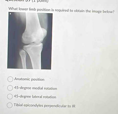 What lower limb position is required to obtain the image below?
Anatomic position
45-degree medial rotation
45-degree lateral rotation
Tibial epicondyles perpendicular to IR