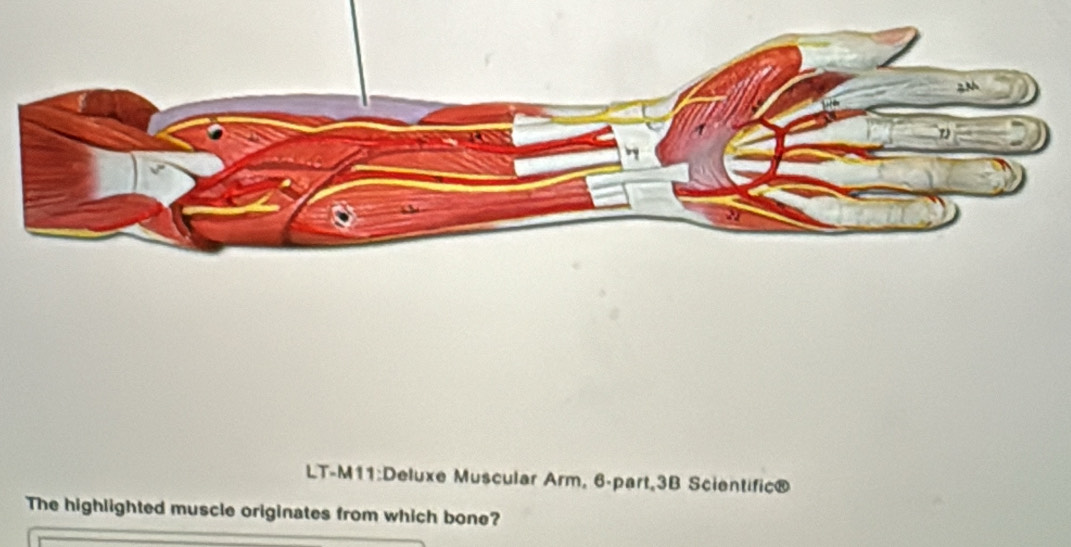 Solved: 2M LT-M11:Deluxe Muscular Arm, 6 -part, 3B Scientific® The ...