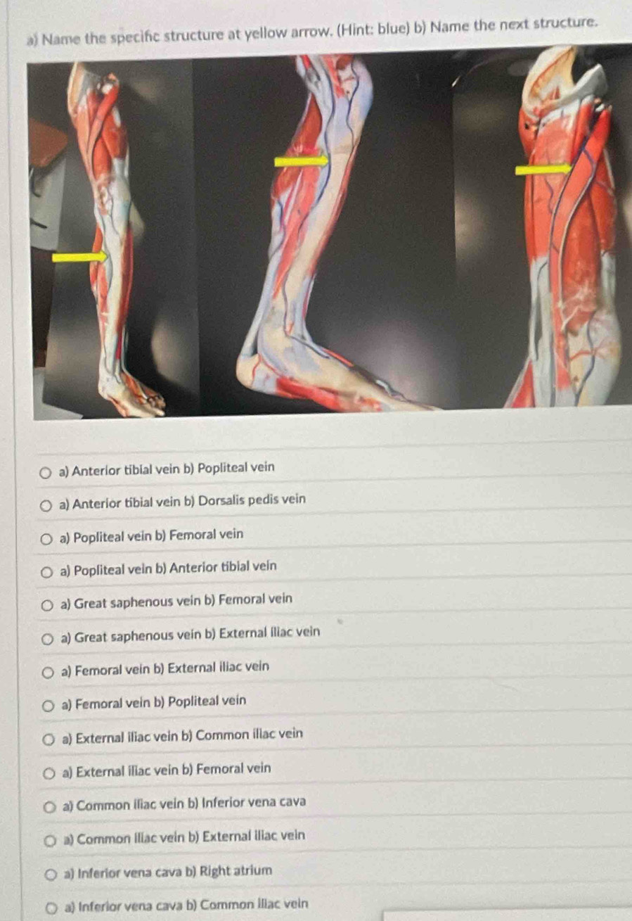 Name the specifc structure at yellow arrow. (Hint: blue) b) Name the next structure.
a) Anterior tibial vein b) Popliteal vein
a) Anterior tibial vein b) Dorsalis pedis vein
a) Popliteal vein b) Femoral vein
a) Popliteal vein b) Anterior tibial vein
a) Great saphenous vein b) Femoral vein
a) Great saphenous vein b) External iliac vein
a) Femoral vein b) External iliac vein
a) Femoral vein b) Popliteal vein
a) External iliac vein b) Common iliac vein
a) External iliac vein b) Femoral vein
a) Common iliac vein b) Inferior vena cava
a) Common iliac vein b) External iliac vein
a) Inferior vena cava b) Right atrium
a) Inferior vena cava b) Common iliac vein