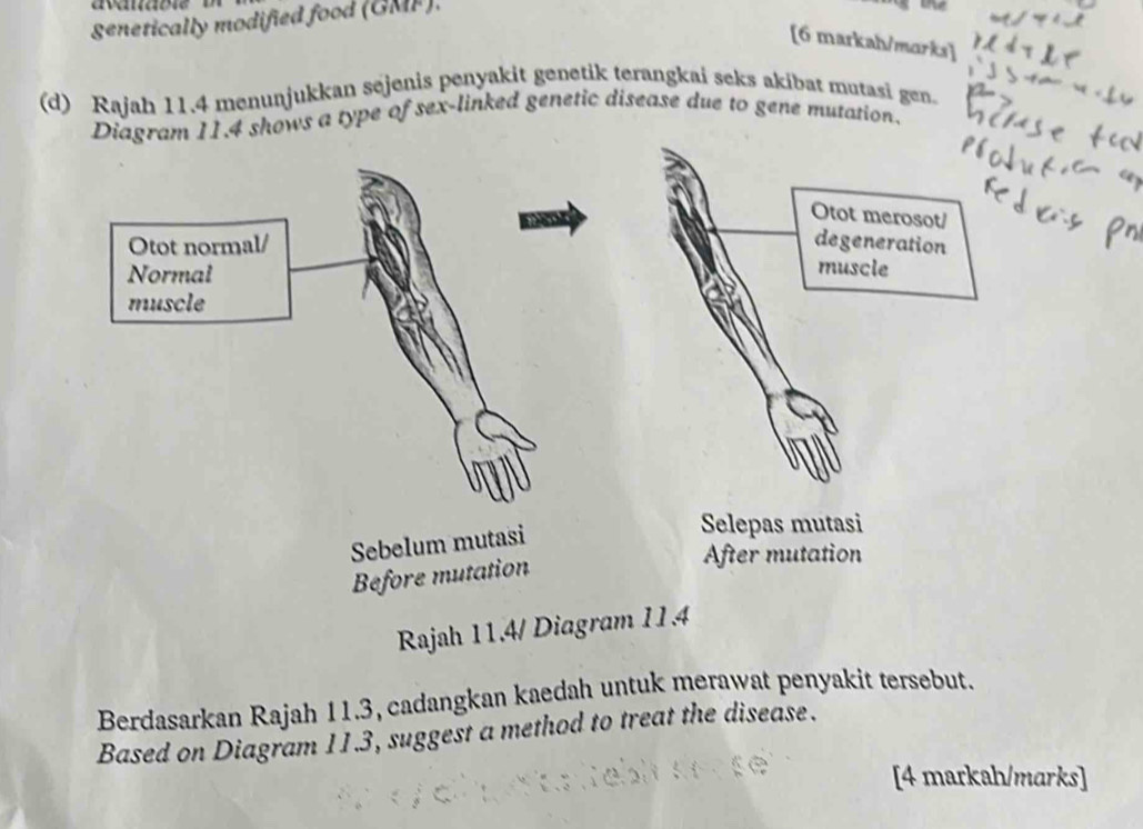 avatabte 
genetically modified food (GMF). 
[6 markah/marks] 
(d) Rajah 11.4 menunjukkan sejenis penyakit genetik terangkai seks akibat mutasi gen. 
shows a type of sex-linked genetic disease due to gene mutation. 
Rajah 11.4/ Diagram 11.4 
Berdasarkan Rajah 11.3, cadangkan kaedah untuk merawat penyakit tersebut. 
Based on Diagram 11.3, suggest a method to treat the disease. 
[4 markah/marks]