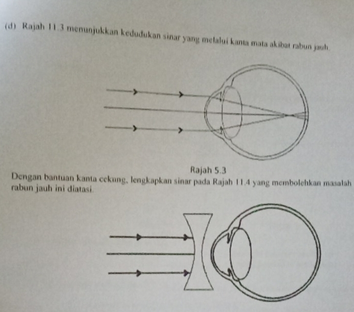 Rajah 11.3 menunjukkan kedudukan sinar yang melalui kanta mata akibat rabun jauh. 
Rajah 5.3 
Dengan bantuan kanta cekung, lengkapkan sinar pada Rajah 11.4 yang membolehkan masalah 
rabun jauh ini diatasi.