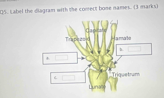 Label the diagram with the correct bone names. (3 marks)