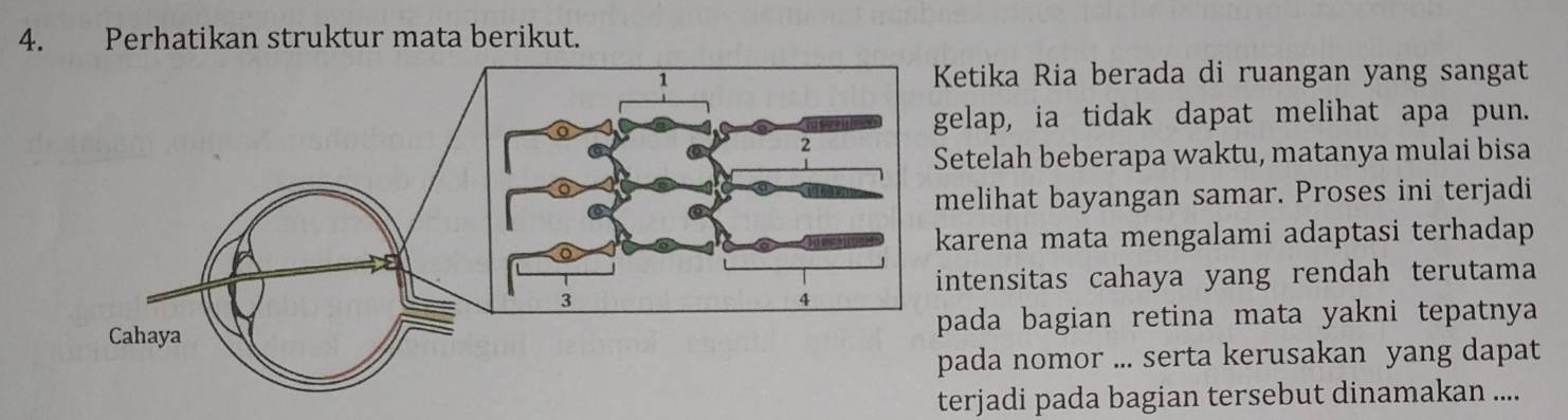 Perhatikan struktur mata berikut. 
etika Ria berada di ruangan yang sangat 
elap, ia tidak dapat melihat apa pun. 
etelah beberapa waktu, matanya mulai bisa 
elihat bayangan samar. Proses ini terjadi 
arena mata mengalami adaptasi terhadap 
ntensitas cahaya yang rendah terutama 
ada bagian retina mata yakni tepatnya 
ada nomor ... serta kerusakan yang dapat 
terjadi pada bagian tersebut dinamakan ....