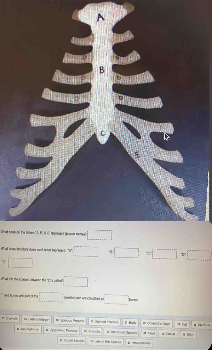 What bone do the letters "A AB, AC' represent (proper name)? □ 
What bone/structure does each letter represent: "A" □ □ 'C' □
"E": □ 
What are the spaces between the "D's called? □ 
These bones are part of the □ skeletor and are classified as □ bones
# Clavicle # Lateral Margin # Spinous Process # Xiphoid Process # Body # Costal Cartilage # Flat # Sternum
# Mandubrium # Zygomatic Process # Scapula # Intercostal Spaces # Axial # Costal # Short
# Costal Margin # Lateral Fob Spaces # Appendicular