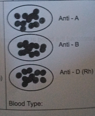 Rh) 
Blood Type: