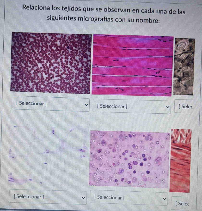 Relaciona los tejidos que se observan en cada una de las 
siguientes micrografías con su nombre: 
[ Seleccionar ] [ Seleccionar ] [ Selec 
[ Seleccionar ] [ Seleccionar ] 
[ Selec