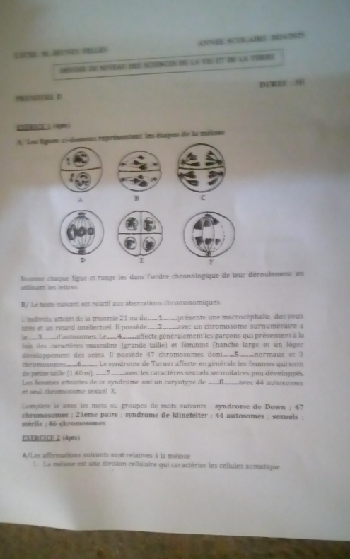 LYCHL NLJEUNES VELLES ANNEE SCOLARE 2624/2625
devoir de niveau dIs Sciènces de la vIe et de la térRé
MERE D DIREF: 3E
EBCE  (  pbs )
A/ Les figues ci-dessous représentent les étapes de la méinse
A B C
Nomme chaque figue et range les dans l'ordre chronologique de leur déroulement en
utilisant les lettres
B/ Le texte suivant est relatif aux aberrations chromosomiques
l. idivide atteint de la trisomie 21 ou du .....1......présente une macrocéphalie, des yeux
tires et un retard intellectuel. Il possède.......2......avec un chromosome surnuméraire a
ja __3_.d'autosomes. Le ......4......affecte généralement les garçons qui présentent à la
fois des caractères masculins (grande taille) et féminins (hanche large et un léger
développement des seins. Il possède 47 chromosomes dont....5.....normaux et 3
romosomes .6......... Le syndrome de Turner affecte en générale les femmes qui sont
de pette taille (1.40 m), .....7.....avec les caractères sexuels secondaires peu développés
Les femmes atteintes de ce syndrome ont un caryotype de ......8........avec 44 autosomes
et seul chromosome sexuel X.
Complete le avec les mots ou groupes de mots suivants syndrome de Down ; 47
chromosomes ; 21eme paire ; syndrome de klinefelter ; 44 autosomes ; sexuels ;
érile : 46 chromosomes
EXERCICE 2 (4pts)
A/Les affirmations suivants sont relatives à la méiose
1 La méiose est une division cellulaire qui caractérise les cellules somatique